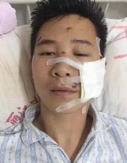 丽江伤人事件：丽江毁容抢劫又有二名受害者站出来！
