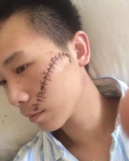 丽江伤人事件：丽江毁容抢劫又有二名受害者站出来！